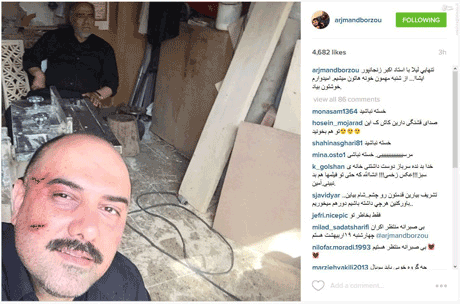 عکس صورت مشت خورده برزو ارجمند مرداد 94